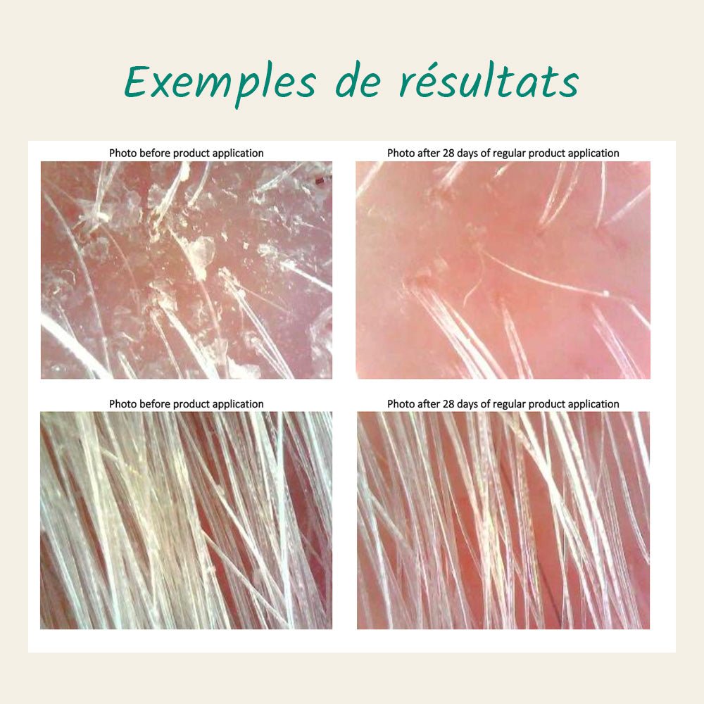 Duo Purifiant Cheveux 360 (pellicule et ou démangeaison) - DAMERET