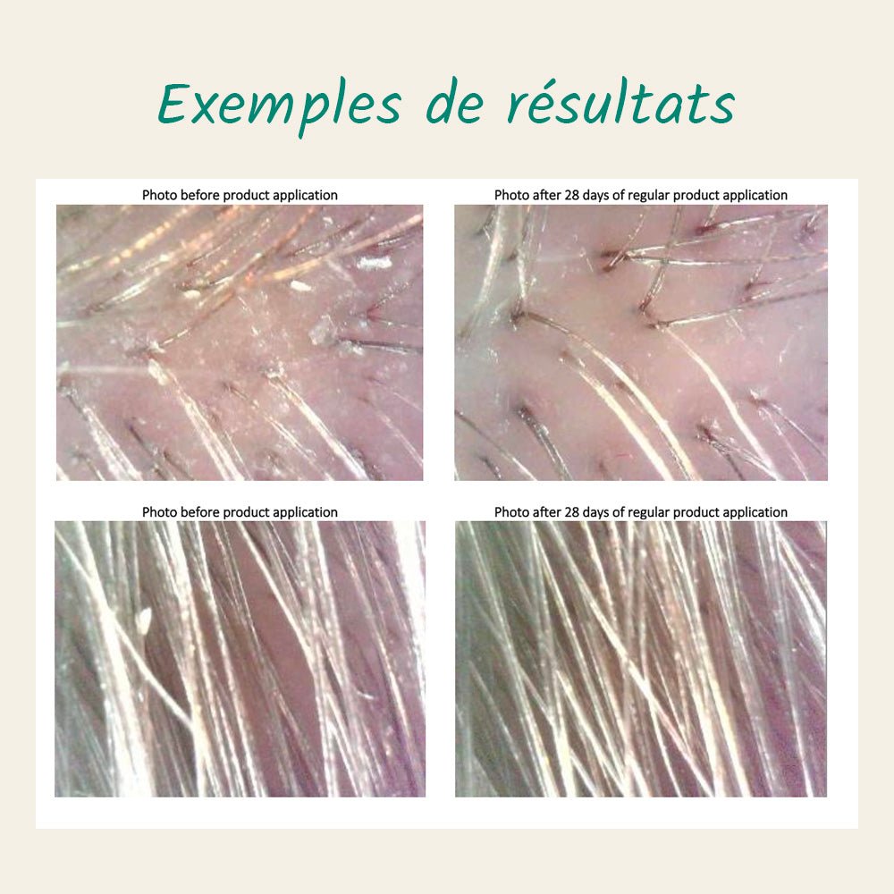 Duo Purifiant Cheveux 360 (pellicule et ou démangeaison) - DAMERET