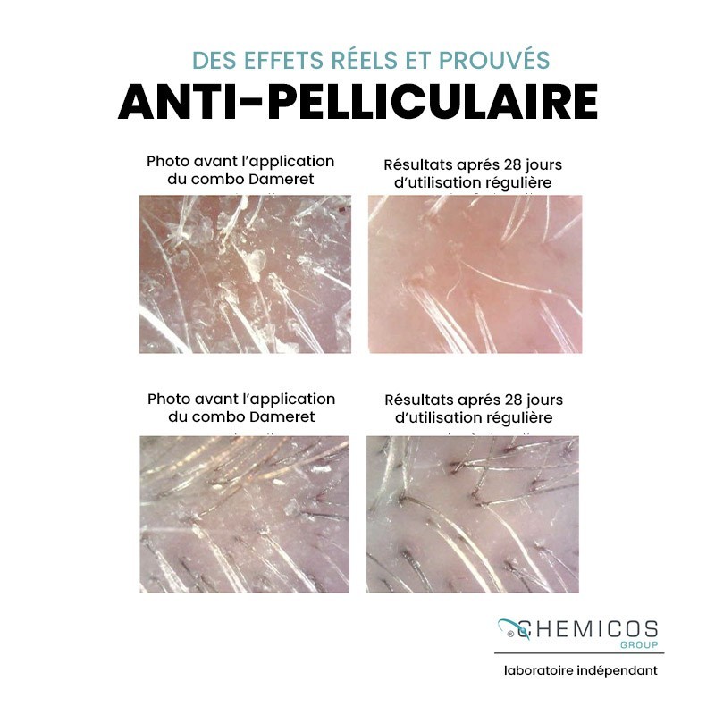 Le Duo Anti-démangeaison et Anti-pelliculaire - DAMERET